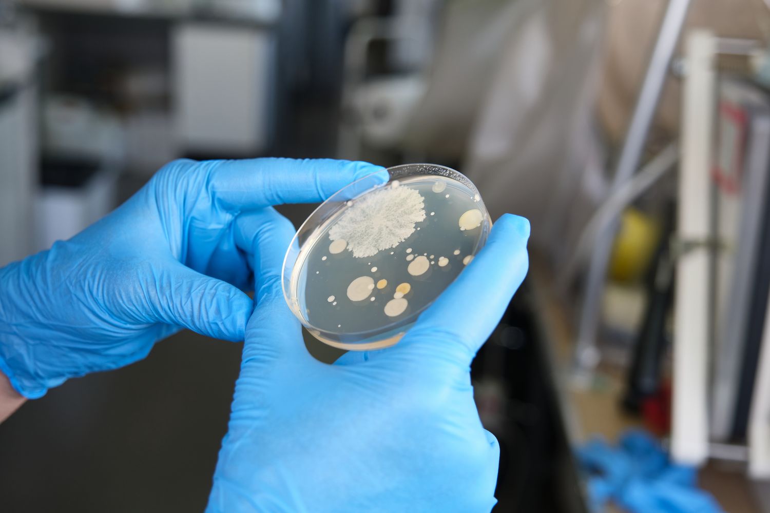 Petri dish with microbial growth in laboratory.
